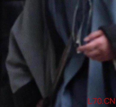 杨洋复工手还肿着